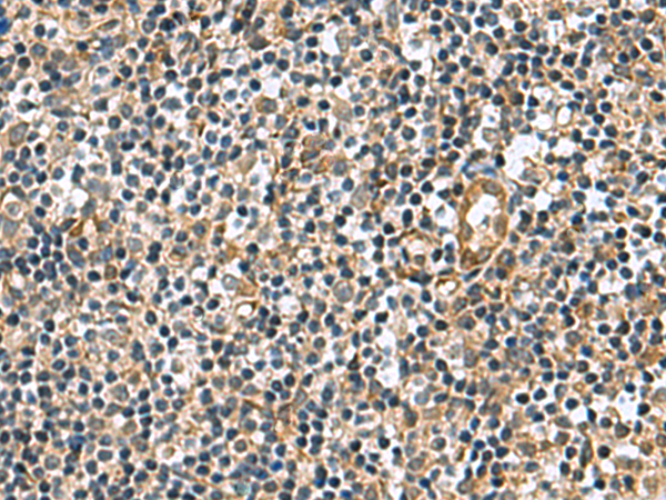 Immunohistochemistry of paraffin-embedded Human tonsil tissue  using TGM3 Polyclonal Antibody at dilution of 1:110(×200)