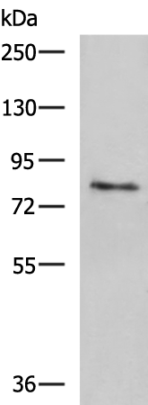 Western blot analysis of Human skin tissue lysate  using TGM3 Polyclonal Antibody at dilution of 1:1600