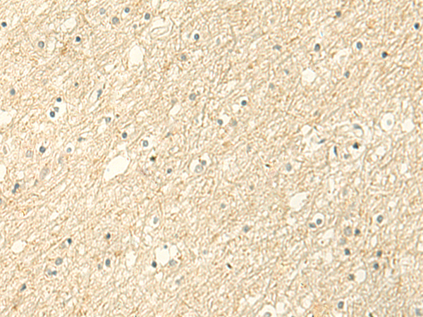 Immunohistochemistry of paraffin-embedded Human brain tissue  using ALPK1 Polyclonal Antibody at dilution of 1:50(×200)