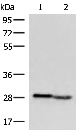 Western blot analysis of Human fetal intestines tissue and Human fetal liver tissue lysates  using KLRB1 Polyclonal Antibody at dilution of 1:800