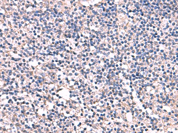 Immunohistochemistry of paraffin-embedded Human tonsil tissue  using ESM1 Polyclonal Antibody at dilution of 1:55(×200)