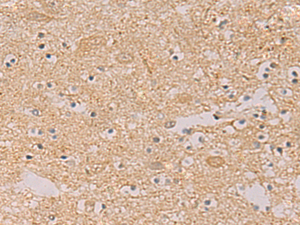 Immunohistochemistry of paraffin-embedded Human brain tissue  using PTPRN Polyclonal Antibody at dilution of 1:55(×200)