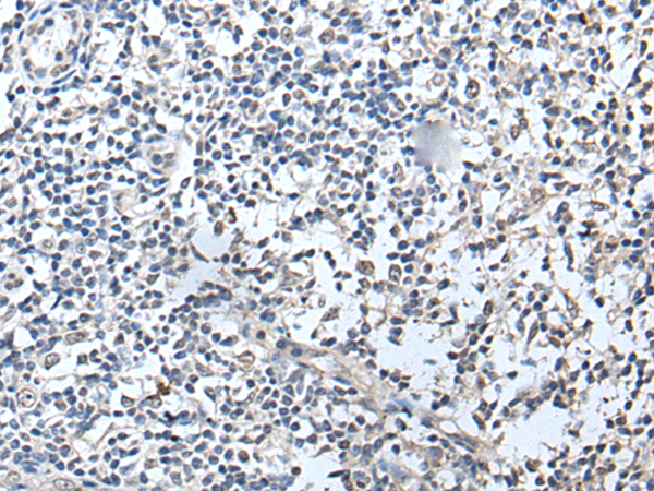 Immunohistochemistry of paraffin-embedded Human tonsil tissue  using RERG Polyclonal Antibody at dilution of 1:50(×200)