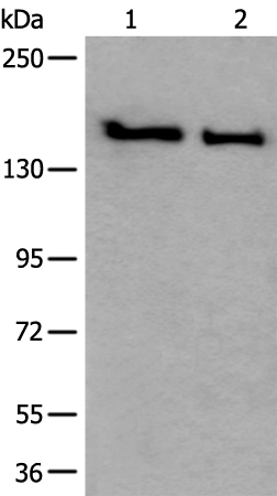 Western blot analysis of HUVEC and Jurkat cell lysates  using SMC1A Polyclonal Antibody at dilution of 1:300