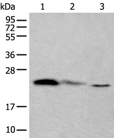 Western blot analysis of 293T and Hela cell lysates  using TPT1 Polyclonal Antibody at dilution of 1:450