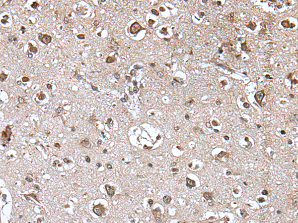 Immunohistochemistry of paraffin-embedded Human brain tissue  using TRIM27 Polyclonal Antibody at dilution of 1:45(×200)