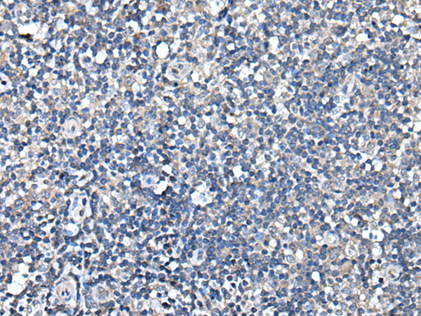 Immunohistochemistry of paraffin-embedded Human tonsil tissue  using TRIM23 Polyclonal Antibody at dilution of 1:55(×200)