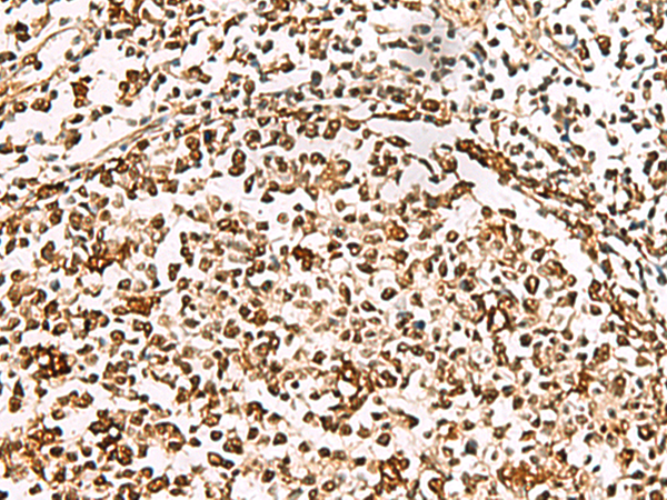 Immunohistochemistry of paraffin-embedded Human tonsil tissue  using XRCC4 Polyclonal Antibody at dilution of 1:60(×200)