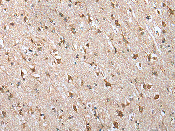 Immunohistochemistry of paraffin-embedded Human brain tissue  using HIF1A Polyclonal Antibody at dilution of 1:45(×200)
