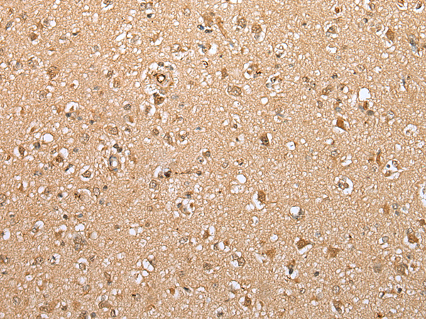 Immunohistochemistry of paraffin-embedded Human brain tissue  using ATXN7L3 Polyclonal Antibody at dilution of 1:35(×200)