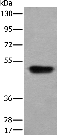 Western blot analysis of Human fetal liver tissue lysate  using HNRNPH2 Polyclonal Antibody at dilution of 1:400