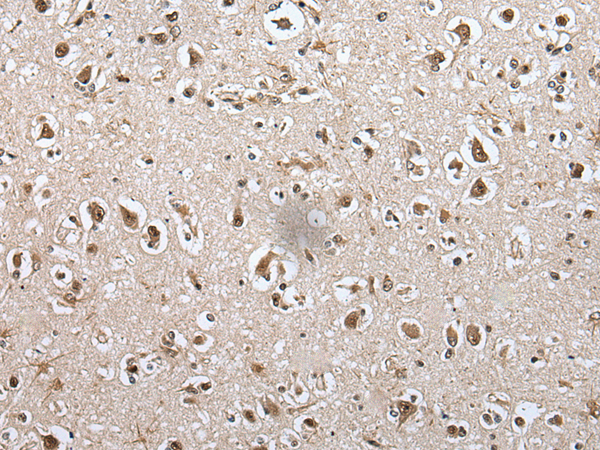 Immunohistochemistry of paraffin-embedded Human brain tissue  using METAP1D Polyclonal Antibody at dilution of 1:60(×200)