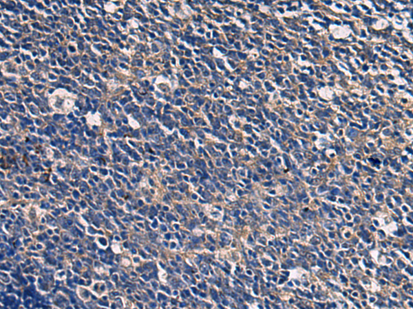 Immunohistochemistry of paraffin-embedded Human tonsil tissue  using ABHD14B Polyclonal Antibody at dilution of 1:60(×200)