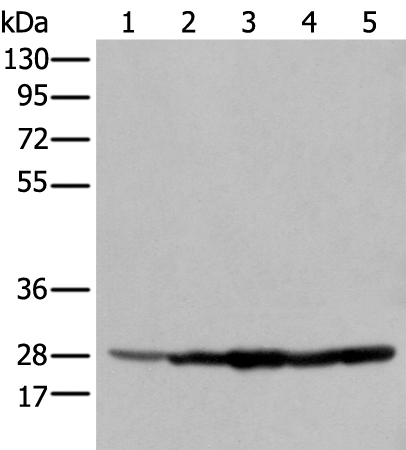Western blot analysis of 293T cell Hela cell A549 cell  using ECI1 Polyclonal Antibody at dilution of 1:350