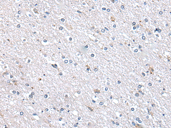 Immunohistochemistry of paraffin-embedded Human brain tissue  using METTL7A Polyclonal Antibody at dilution of 1:40(×200)