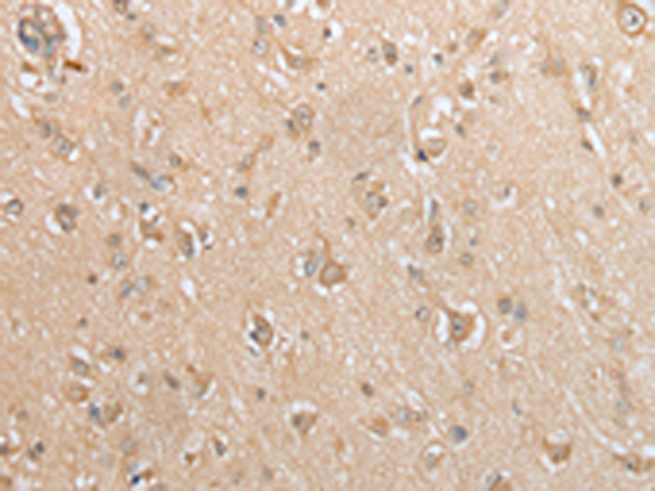 Immunohistochemistry of paraffin-embedded Human brain tissue  using GCLC Polyclonal Antibody at dilution of 1:35(×200)