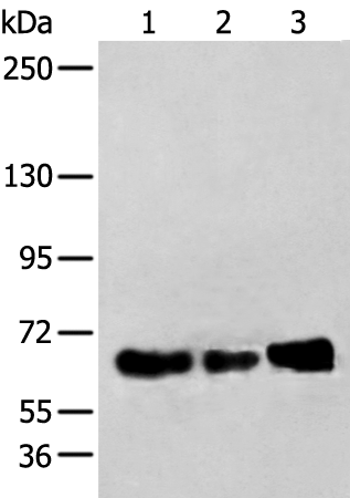 Western blot analysis of TM4 K562 and A431 cell lysates  using ZBTB5 Polyclonal Antibody at dilution of 1:250