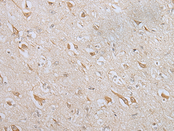 Immunohistochemistry of paraffin-embedded Human brain tissue  using ZNF281 Polyclonal Antibody at dilution of 1:70(×200)