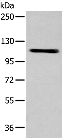 Western blot analysis of A549 cell  using ZNF281 Polyclonal Antibody at dilution of 1:600