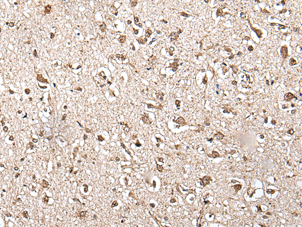 Immunohistochemistry of paraffin-embedded Human brain tissue  using ZFP36 Polyclonal Antibody at dilution of 1:55(×200)