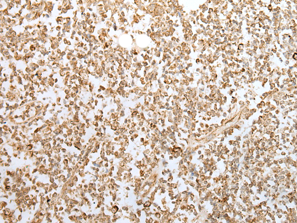 Immunohistochemistry of paraffin-embedded Human tonsil tissue  using ZKSCAN1 Polyclonal Antibody at dilution of 1:30(×200)