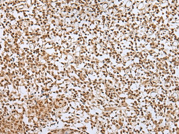 Immunohistochemistry of paraffin-embedded Human tonsil tissue  using ZNF354A Polyclonal Antibody at dilution of 1:40(×200)