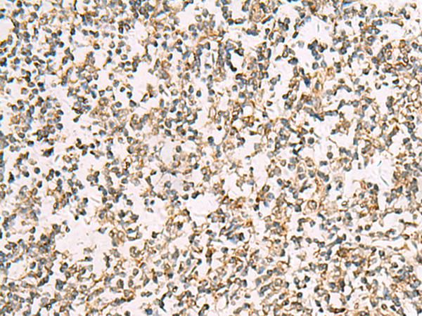 Immunohistochemistry of paraffin-embedded Human tonsil tissue  using ZPBP2 Polyclonal Antibody at dilution of 1:50(×200)