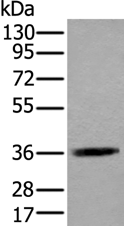 Western blot analysis of Jurkat cell lysate  using ACAT2 Polyclonal Antibody at dilution of 1:550