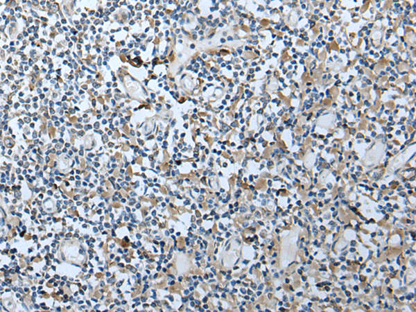 Immunohistochemistry of paraffin-embedded Human tonsil tissue  using VDAC1 Polyclonal Antibody at dilution of 1:35(×200)