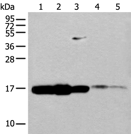 Western blot analysis of 293T cell Mouse spleen tissue and Human spleen tissue lysates  using UBE2V1 Polyclonal Antibody at dilution of 1:400