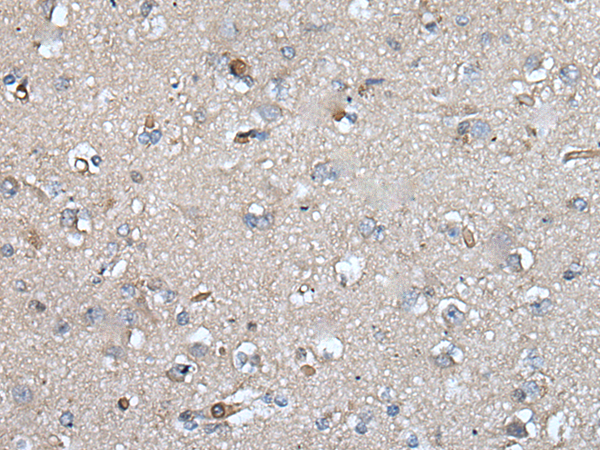 Immunohistochemistry of paraffin-embedded Human brain tissue  using UMPS Polyclonal Antibody at dilution of 1:40(×200)