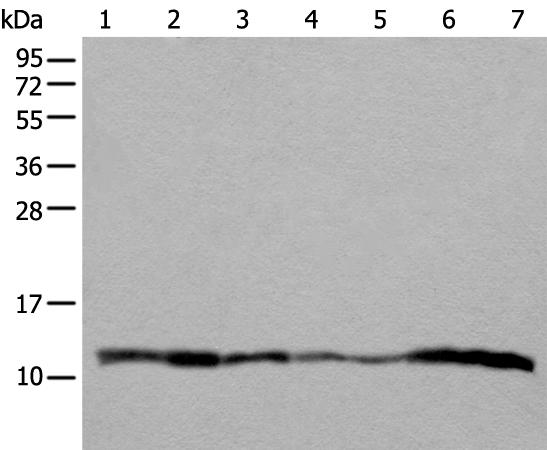 Western blot analysis of 293T A549 Hela and 231 cell Human placenta tissue HEPG2 cell Human fetal liver tissue lysates  using UQCRQ Polyclonal Antibody at dilution of 1:400
