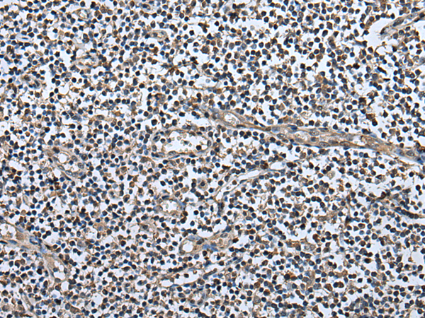 Immunohistochemistry of paraffin-embedded Human tonsil tissue  using UTP3 Polyclonal Antibody at dilution of 1:50(×200)