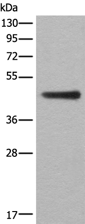 Western blot analysis of A431 cell lysate  using ASS1 Polyclonal Antibody at dilution of 1:300