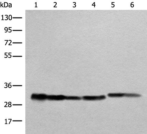 Western blot analysis of Human heart tissue A549 231 Jurkat HEPG2 and Hela cell lysates  using ATP5C1 Polyclonal Antibody at dilution of 1:1000