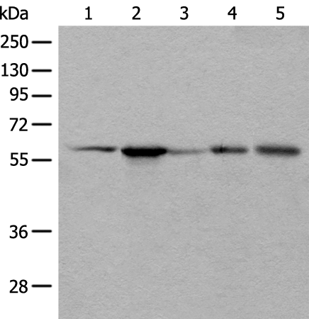 Western blot analysis of HEPG2 Hela A172 A549 and A431 cell lysates  using BAIAP2L1 Polyclonal Antibody at dilution of 1:800