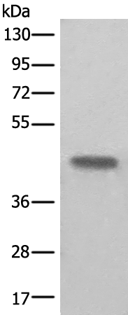 Western blot analysis of Human kidney tissue lysate  using BHMT2 Polyclonal Antibody at dilution of 1:450