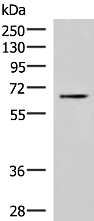 Western blot analysis of Jurkat cell lysate  using BRD9 Polyclonal Antibody at dilution of 1:800