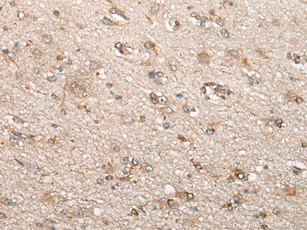 Immunohistochemistry of paraffin-embedded Human brain tissue  using BCHE Polyclonal Antibody at dilution of 1:60(×200)