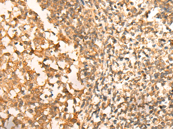 Immunohistochemistry of paraffin-embedded Human tonsil tissue  using CEP57 Polyclonal Antibody at dilution of 1:30(×200)