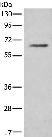 Western blot analysis of Hela cell lysate  using CEP57 Polyclonal Antibody at dilution of 1:450