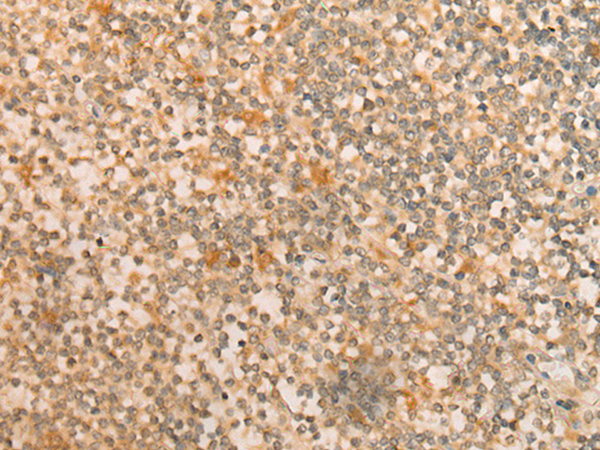 Immunohistochemistry of paraffin-embedded Human tonsil tissue  using CFHR2 Polyclonal Antibody at dilution of 1:35(×200)