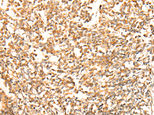 Immunohistochemistry of paraffin-embedded Human tonsil tissue  using CHCHD3 Polyclonal Antibody at dilution of 1:25(×200)