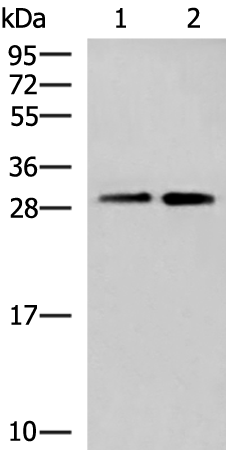 Western blot analysis of A549 cell and Human cerebrum tissue lysates  using TBCB Polyclonal Antibody at dilution of 1:500