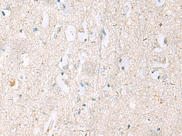 Immunohistochemistry of paraffin-embedded Human brain tissue  using DACT3 Polyclonal Antibody at dilution of 1:55(×200)