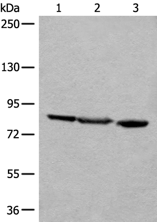 Western blot analysis of A549 Jurkat and HEPG2 cell lysates  using TAGAP Polyclonal Antibody at dilution of 1:400