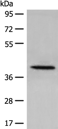 Western blot analysis of 231 cell lysate  using DHRS7 Polyclonal Antibody at dilution of 1:400