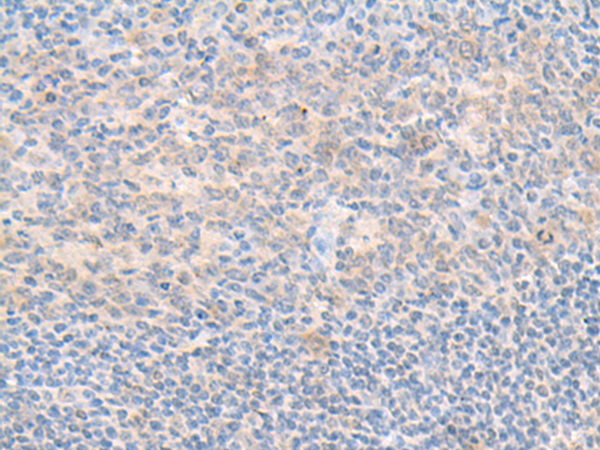 Immunohistochemistry of paraffin-embedded Human tonsil tissue  using SMS Polyclonal Antibody at dilution of 1:70(×200)