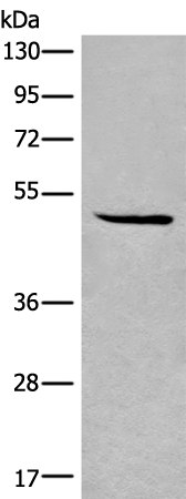 Western blot analysis of HL-60 cell lysate  using SPOCK3 Polyclonal Antibody at dilution of 1:400