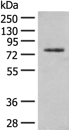 Western blot analysis of Hela cell lysate  using TRMT1 Polyclonal Antibody at dilution of 1:300